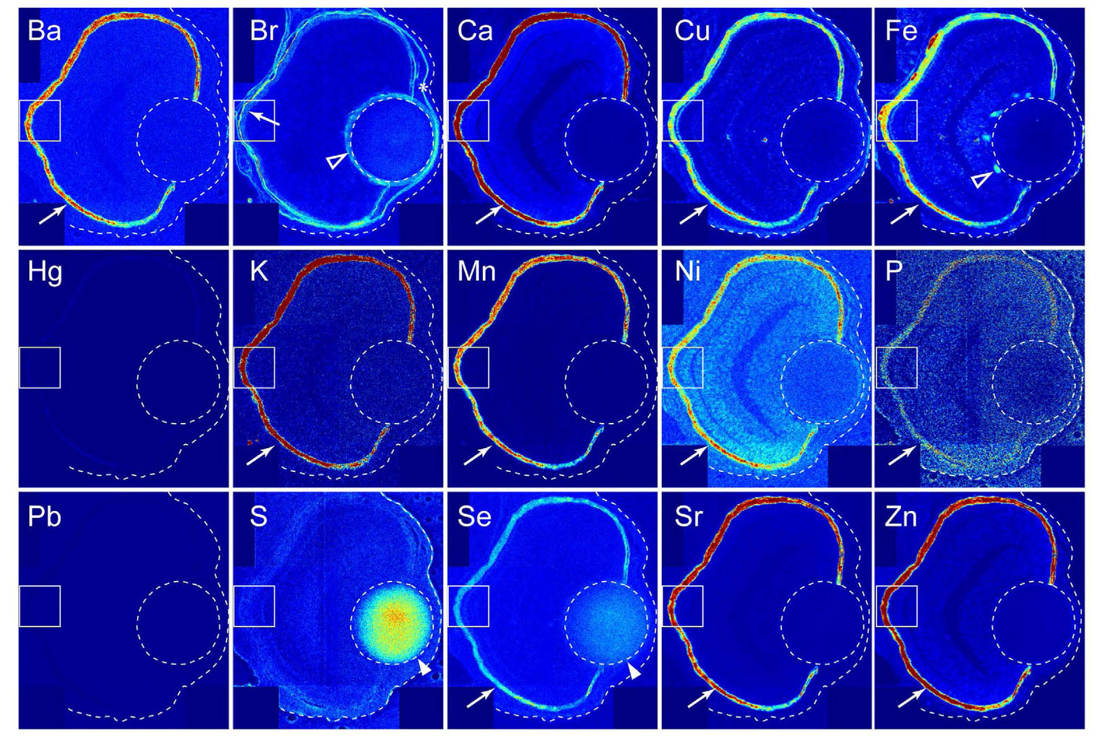 Localization of elements in the eye 