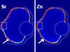 Localization of elements in the eye