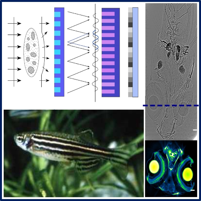 IPS X-Ray Imaging